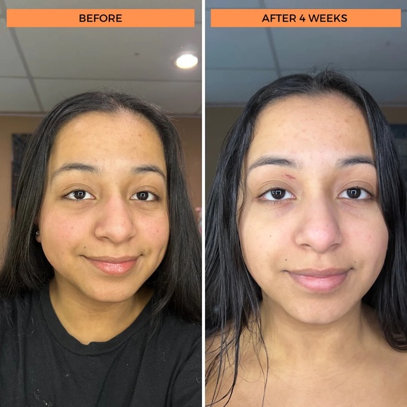 NWOB BeautyStat Universal C Skin Refiner All Skins Full Size 1 fl oz / 30 ml - Picture 12 of 13